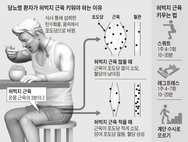 당뇨병 환자가 허벅지 근육을 키워야 하는 이유와 방법을 설명하는 인포그래픽. 남성이 밥을 먹고 있고, 탄수화물이 포도당으로 변환되는 과정과 허벅지 근육이 많을 때와 적을 때의 혈당 변화가 도식화되어 있다. 오른쪽에는 스쿼트, 레그프레스, 계단 오르기 등 허벅지 근육 키우는 운동법이 제시되어 있다.