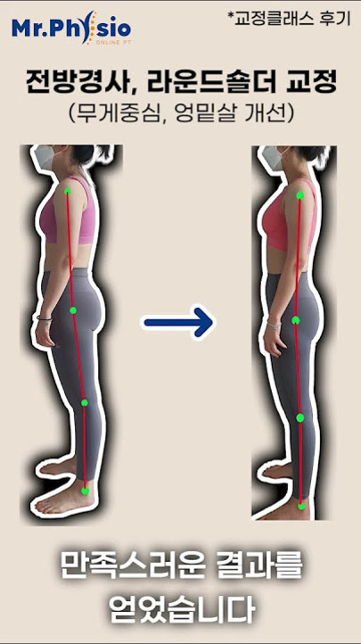 한 여성이 교정 전후의 자세 변화를 보여주는 이미지로, 왼쪽은 어깨와 등이 앞으로 굽어 있고 오른쪽은 곧게 펴진 바른 자세를 하고 있다. 상단에는 '전방경사, 라운드숄더 교정(무게중심, 엉밑살 개선)' 문구가 있으며 하단에는 '만족스러운 결과를 얻었습니다'라는 문구가 있다.