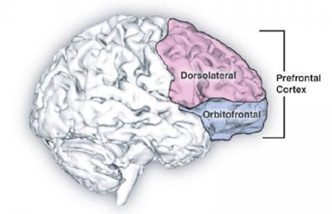 인간 뇌의 측면 이미지로, 전전두엽 피질이 강조되어 있다. Dorsolateral 영역은 분홍색, Orbitofrontal 영역은 파란색으로 표시되어 있다.